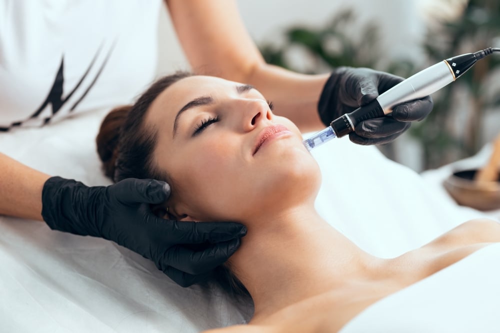 How Often Should You Get Microneedling Treatments?