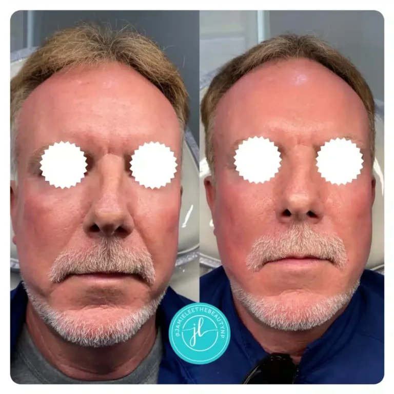 Priority-You-Before-and-After-11