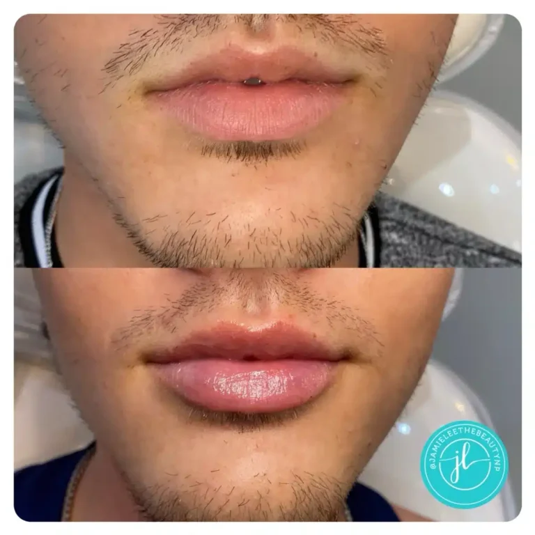 Priority-You-Before-and-After-12