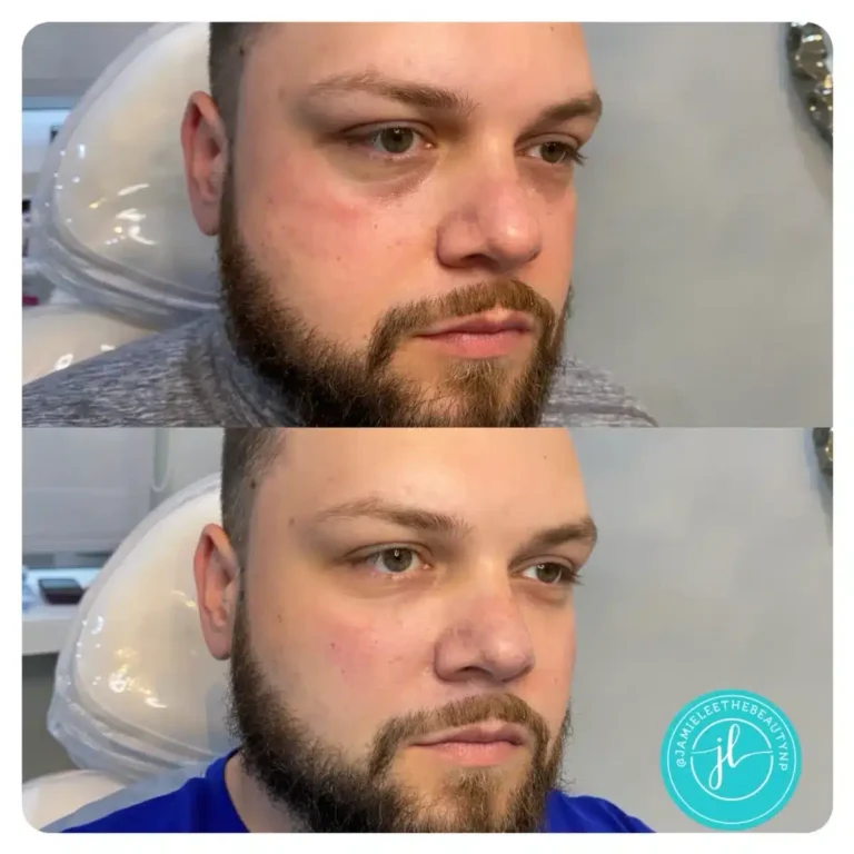Priority-You-Before-and-After-13