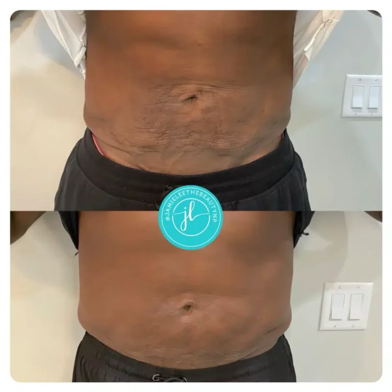 Priority-You-Before-and-After-14