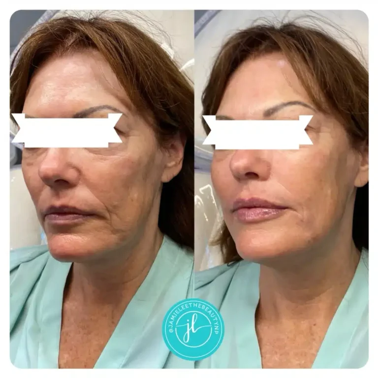 Priority-You-Before-and-After-15