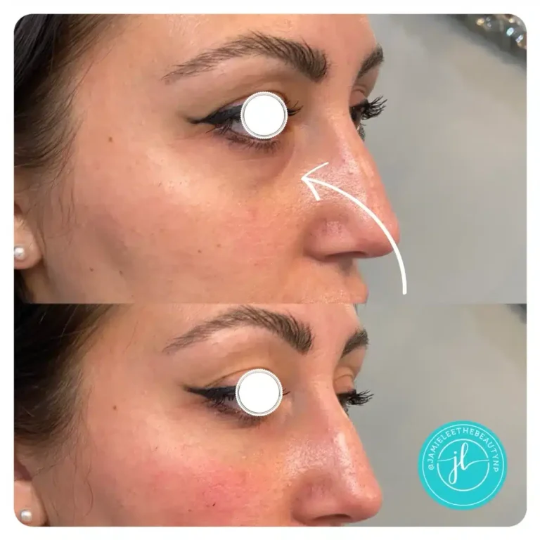 Priority-You-Before-and-After-16