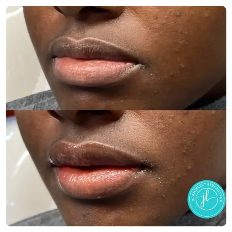 Priority-You-Before-and-After-18
