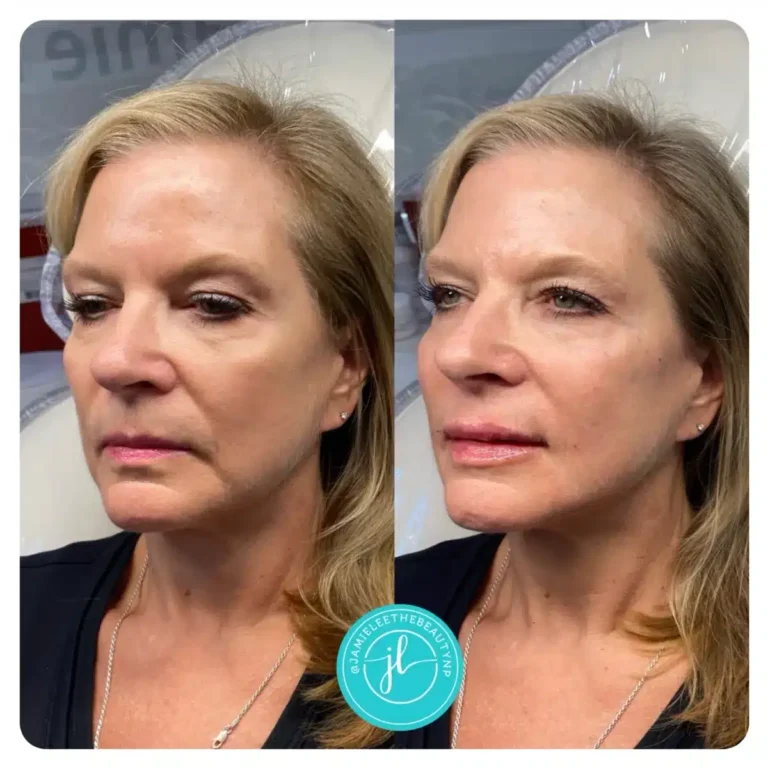 Priority-You-Before-and-After-19