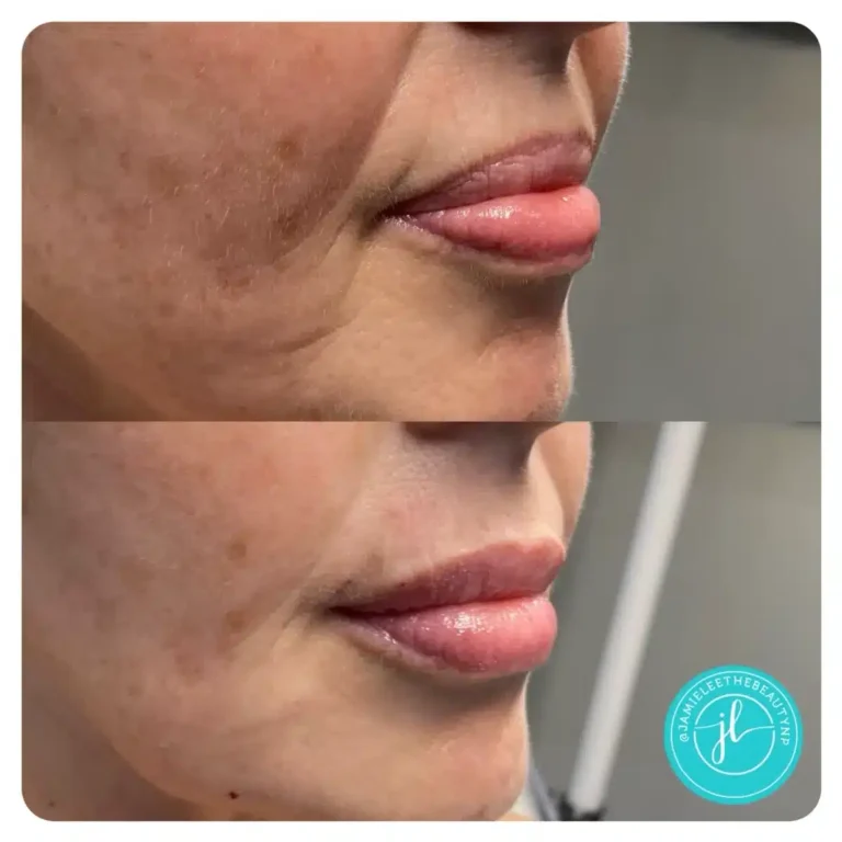 Priority-You-Before-and-After-22