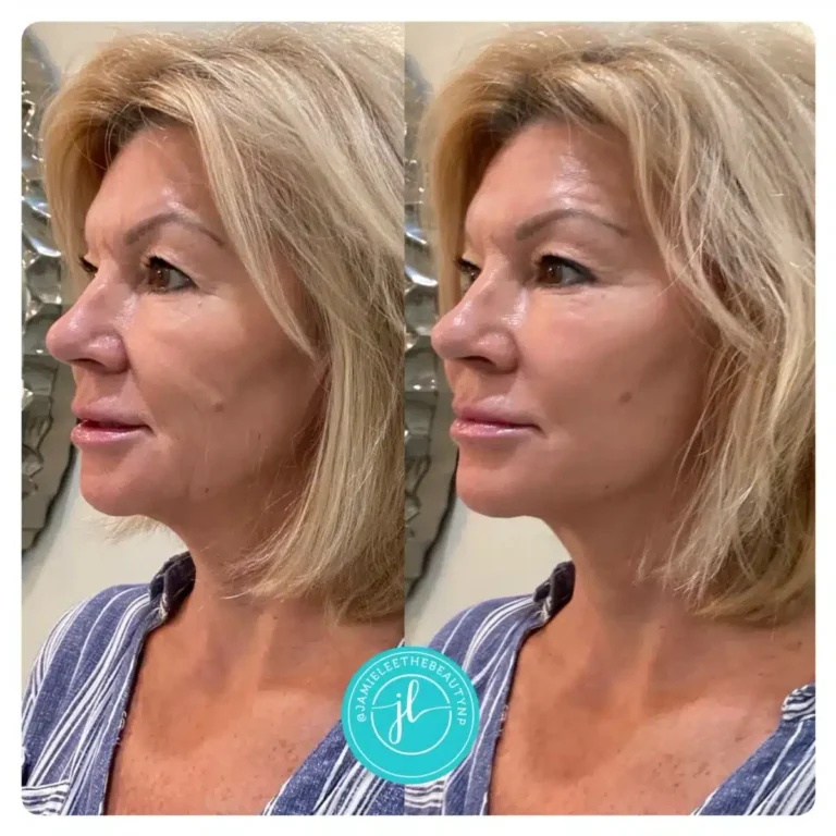 Priority-You-Before-and-After-23