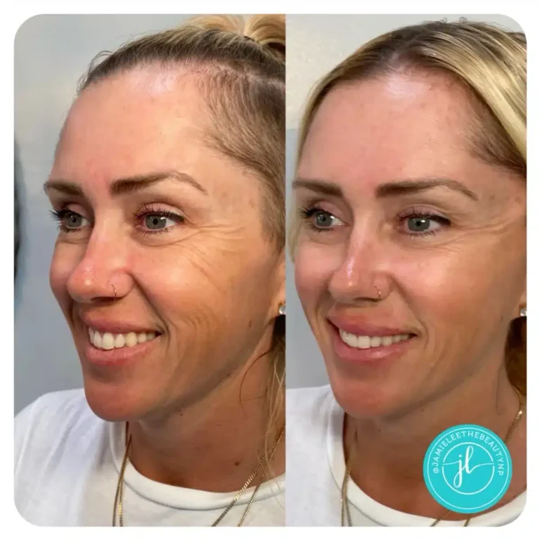Priority-You-Before-and-After-25 - Copy