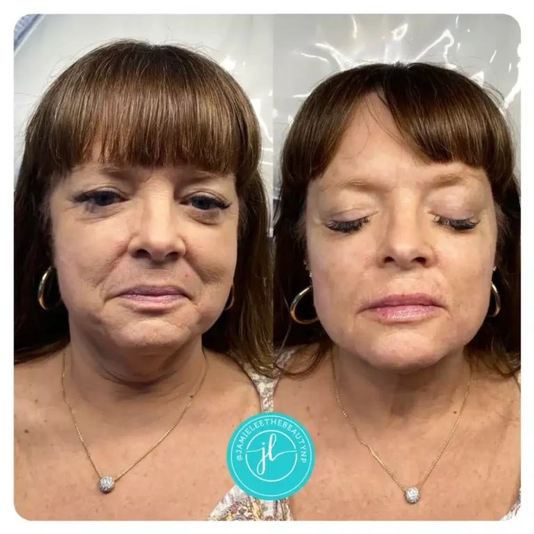 Priority-You-Before-and-After-26 - Copy