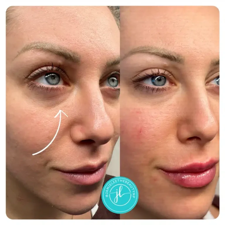 Priority-You-Before-and-After-3