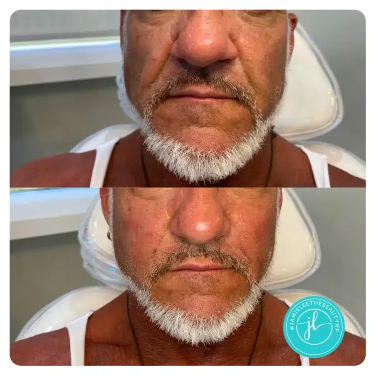 Priority-You-Before-and-After-4