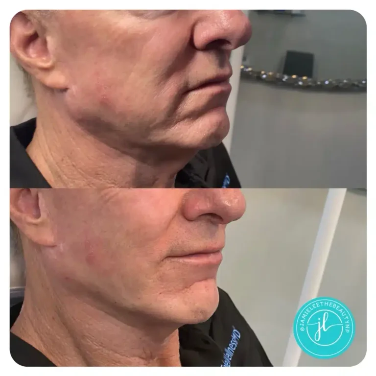 Priority-You-Before-and-After-6