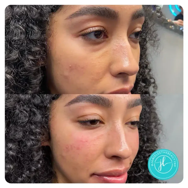 Priority-You-Before-and-After-7